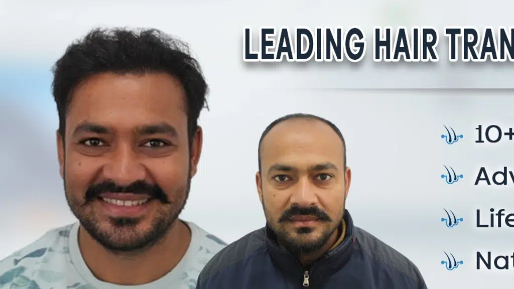 Bhopal Hair Clinic