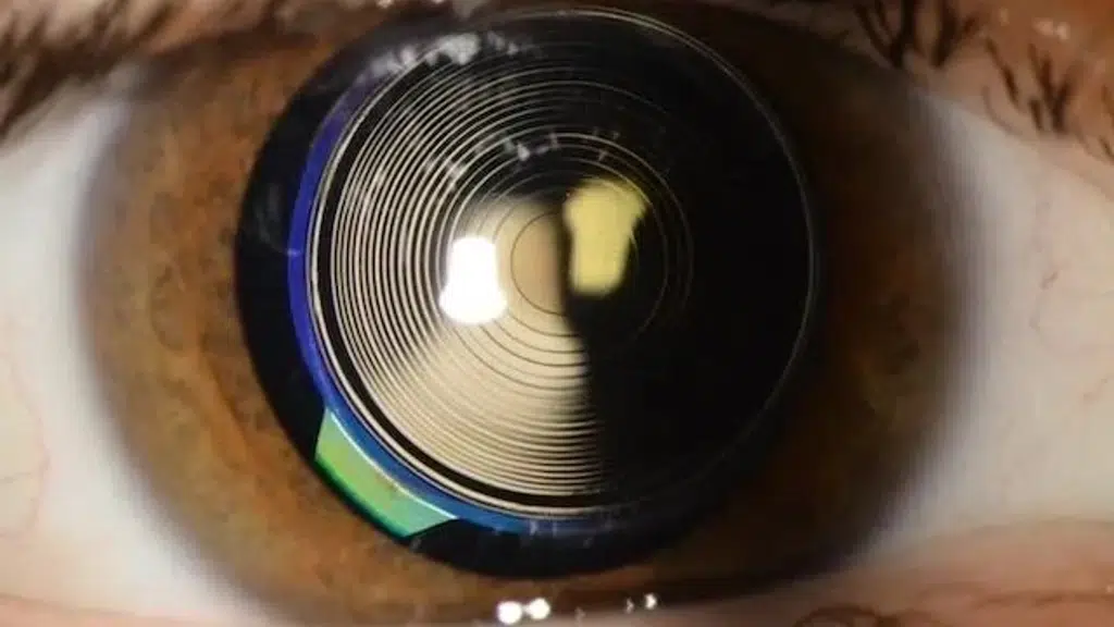 I Care EYE Hospital