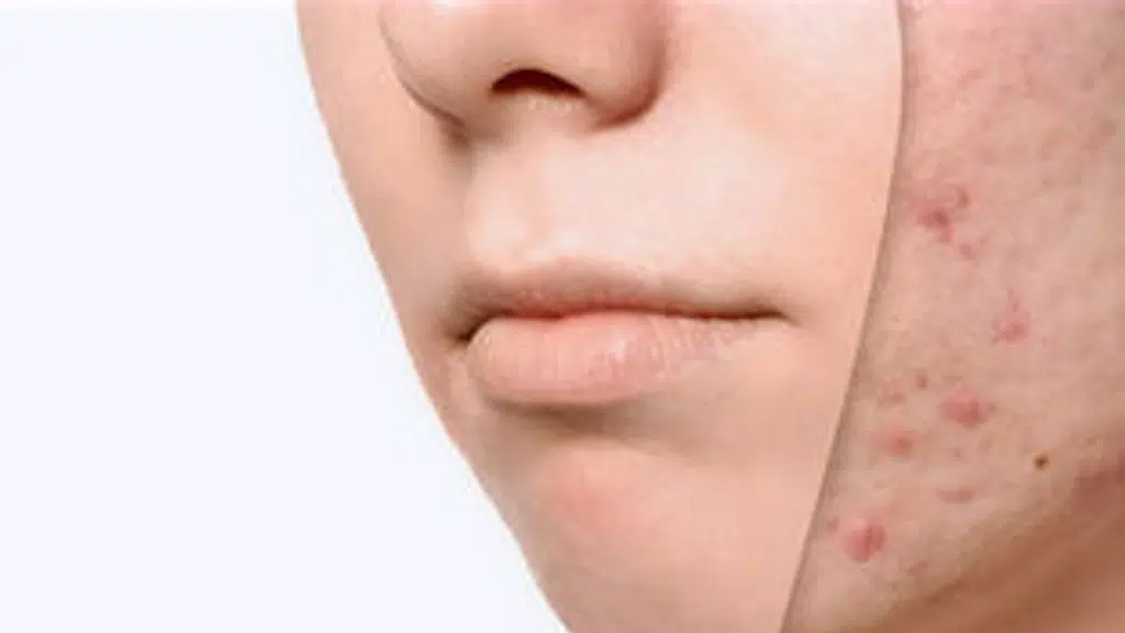 I Perfect Dermatology + Aesthetics