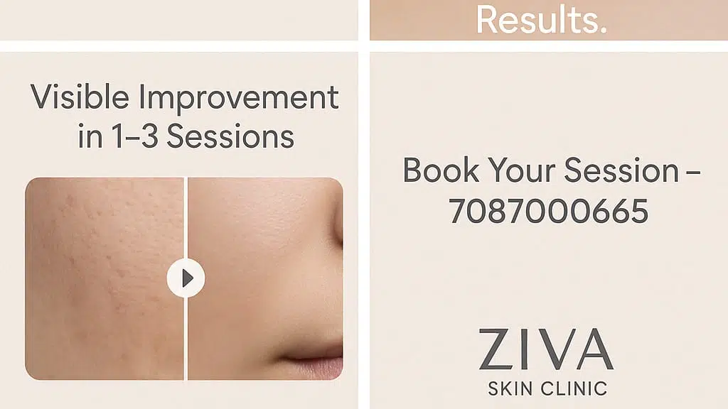 Ziva Skin Clinic