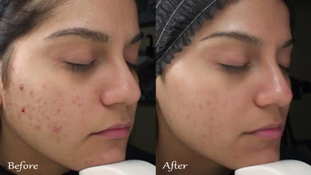Pearl International Beauty Clinic