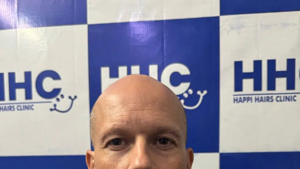 Happi Hairs Clinic