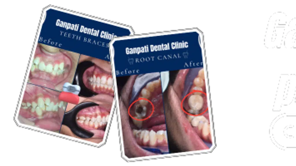 Ganpati Dental Clinic