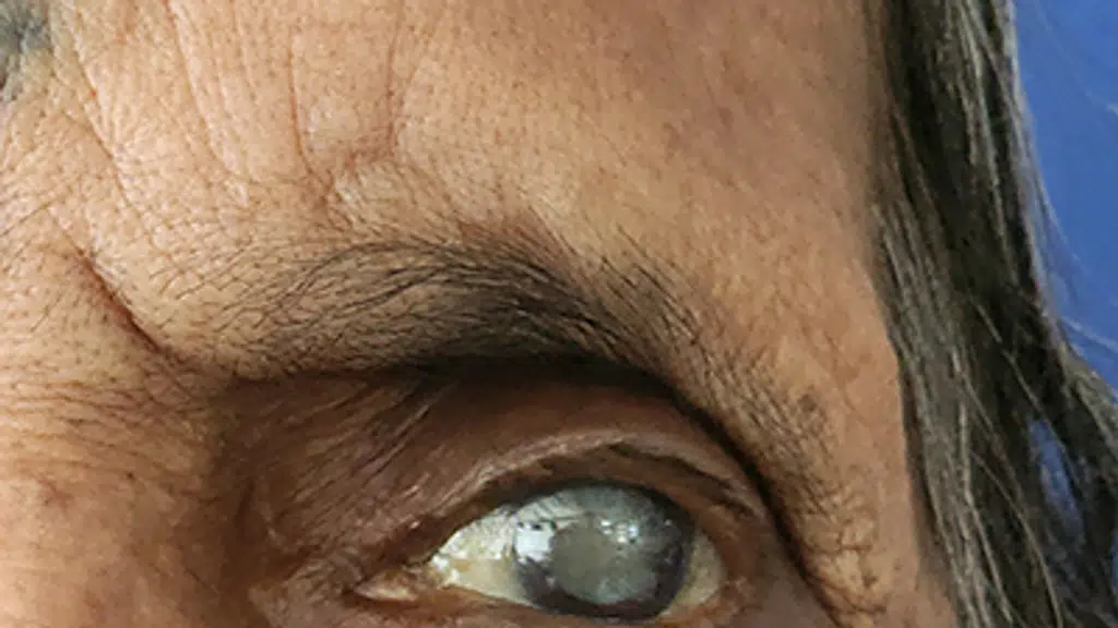 Sourabh Patwardhan Your Eye doctor