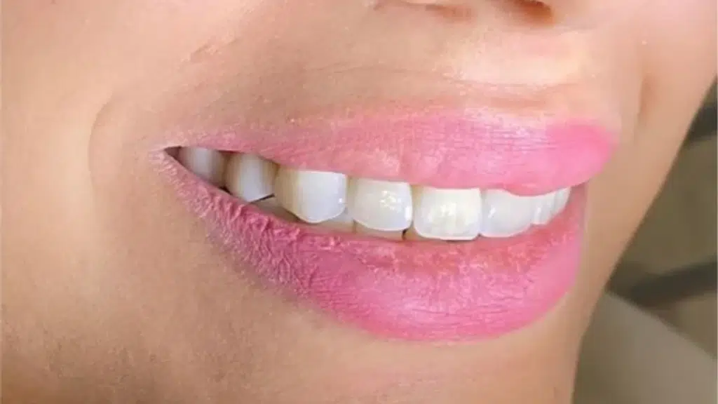 Perfect Dental
