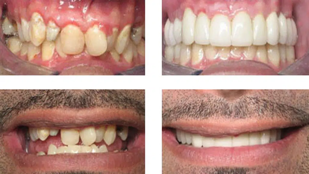 Healthy Teeth Dental Clinic