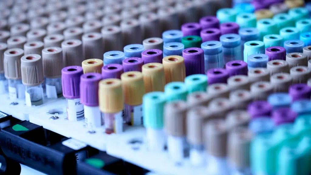 New Diagnostic and Medicine