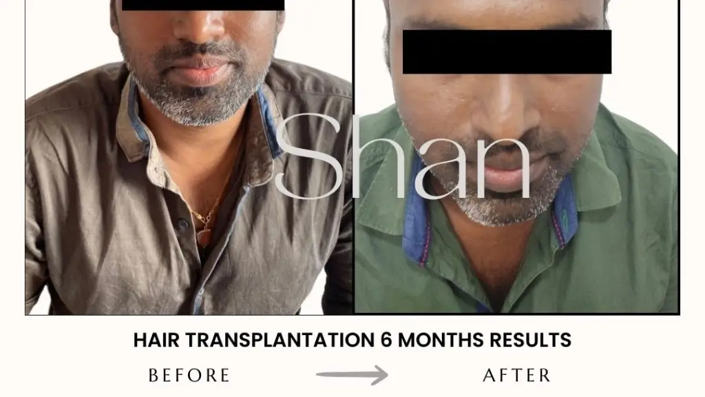 Shan Skin And Hair Clinic