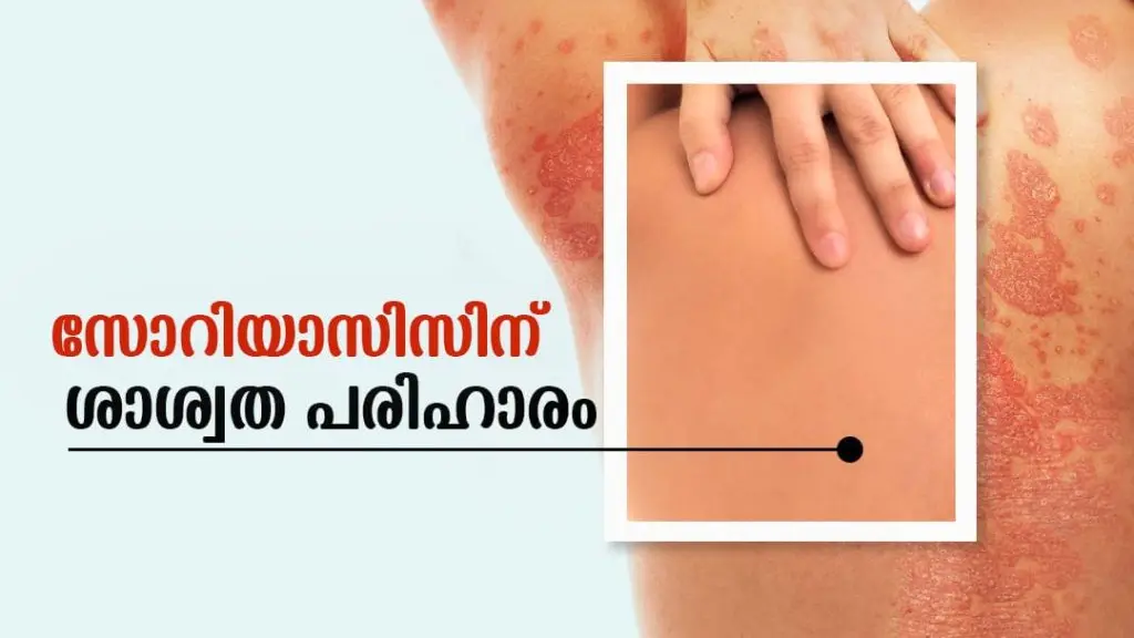 Dr. Sheby's Mareena Panchakarma