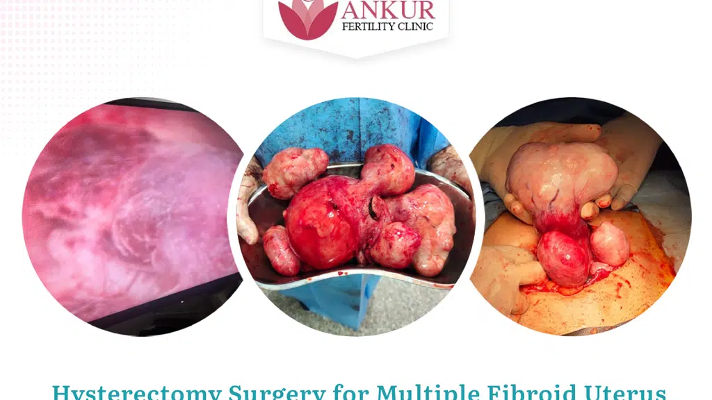 Ankur Fertility Clinic