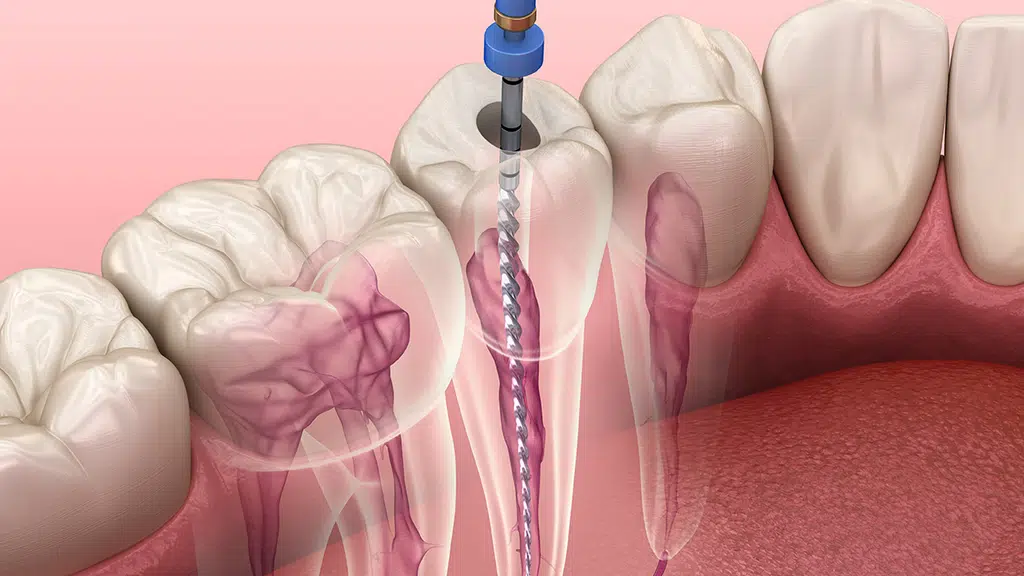 Star International Dental Care