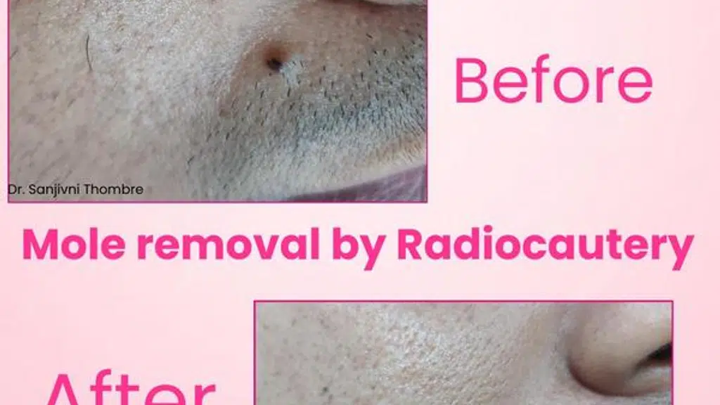 Shreesai Skin Clinic and Laser Center