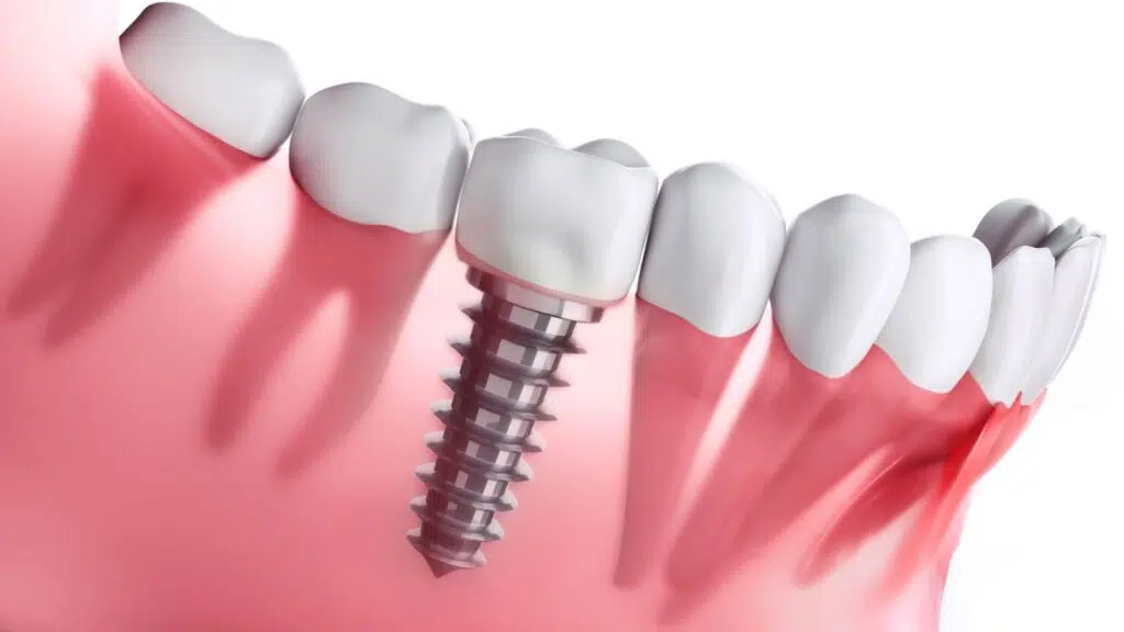 Bari Dental Clinic