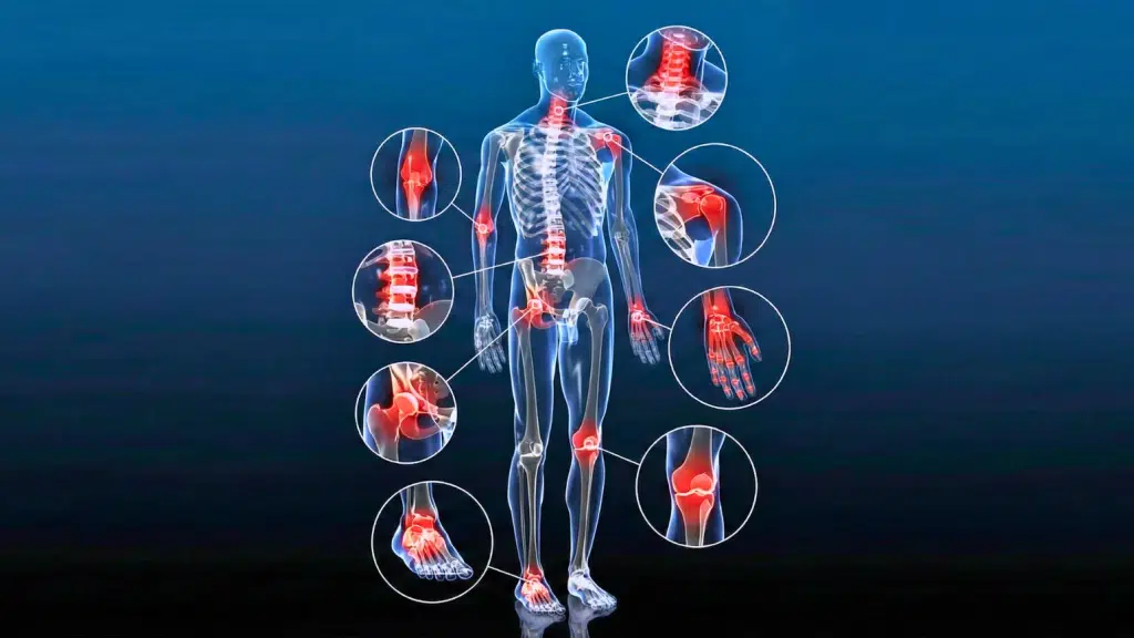 Best Physiotherapy In Delhi & Rehabilitation Center