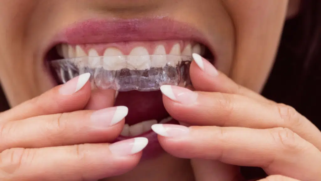 MySmile Dental Clinic
