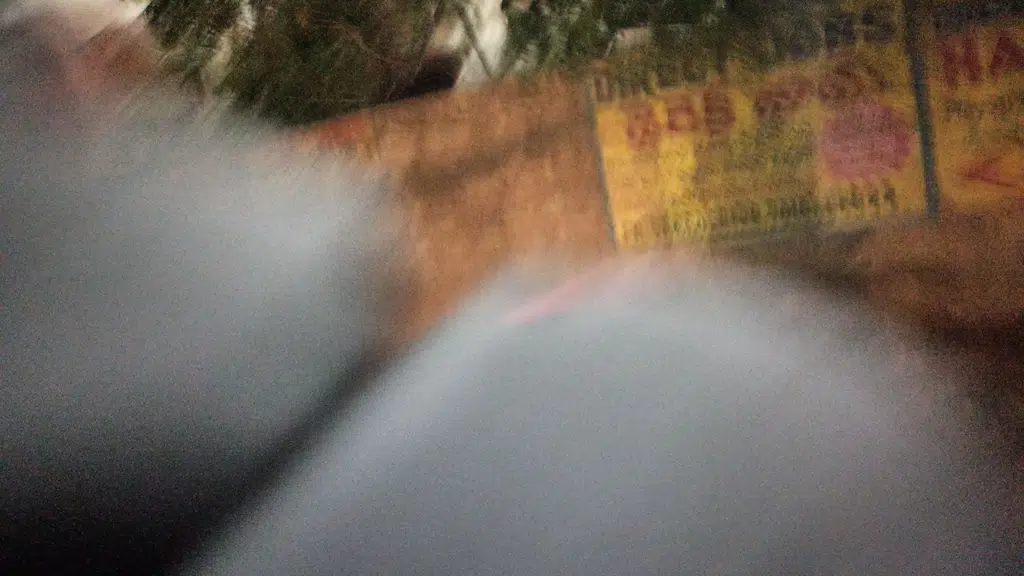 Vijaya Diagnostic Centre, Suchitra