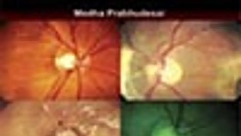Prabhudesai Eye Clinic