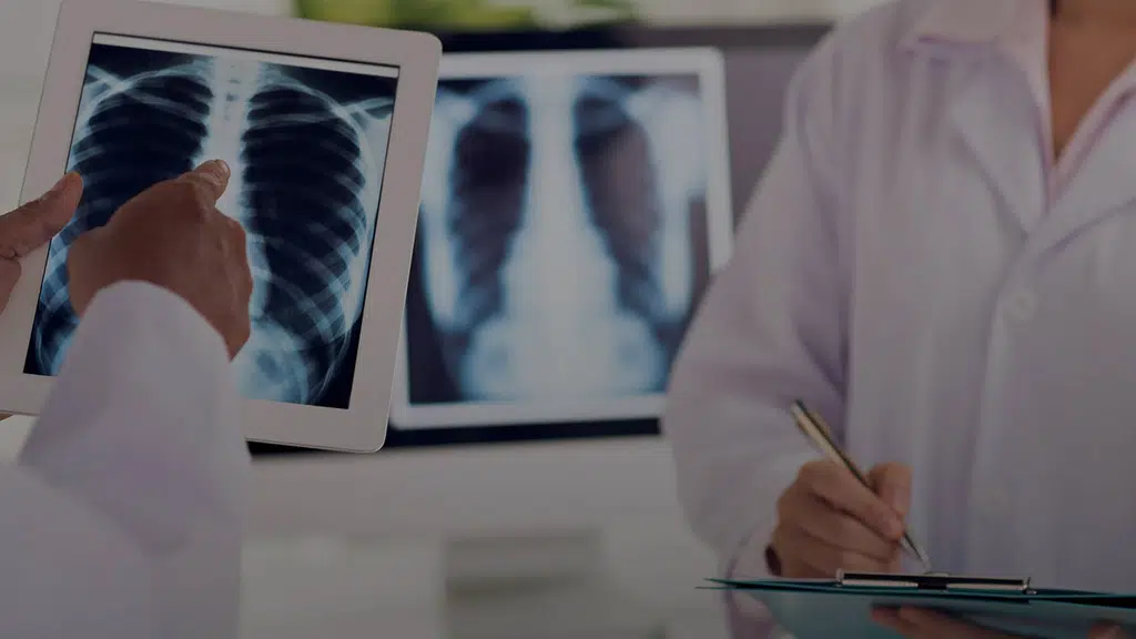 A G mobile X-Rays