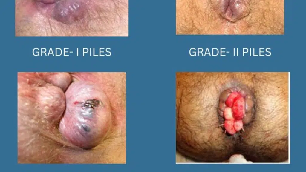 Gastrovedics Lifesciences