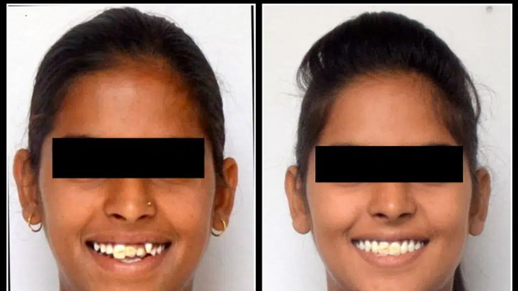 Bombay Dental Clinic