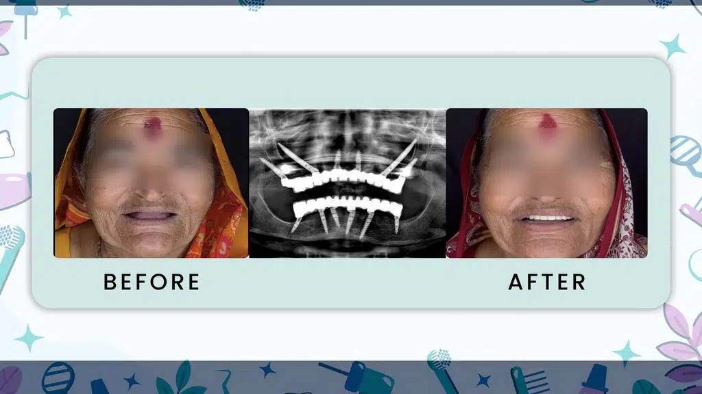 PreciGem Dental World