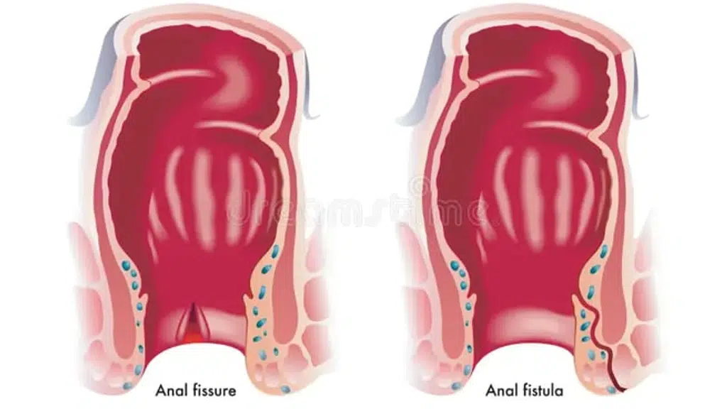 Proctozen Anorectal Clinic