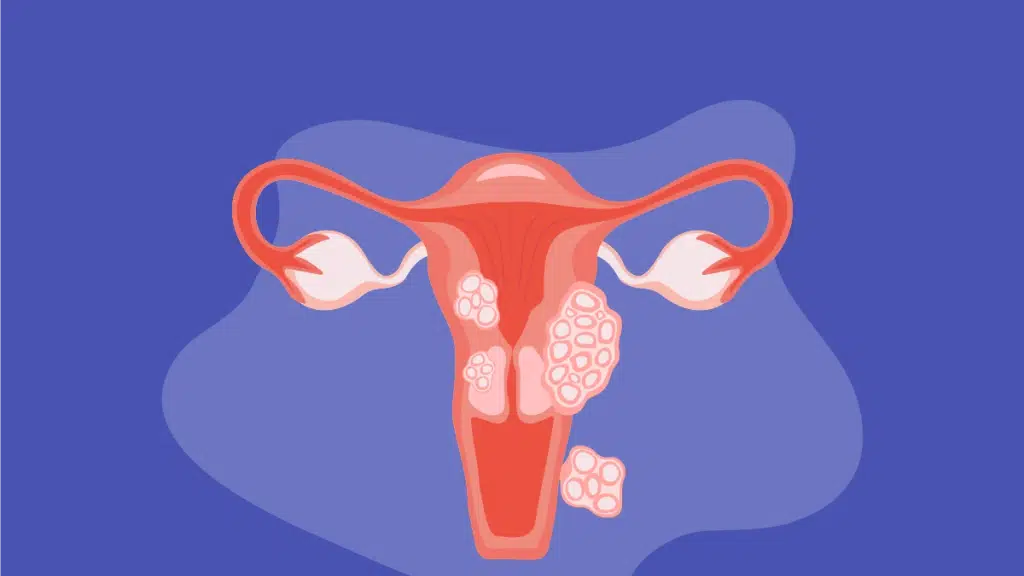 Silver Lining IVF and Endoscopy Centre