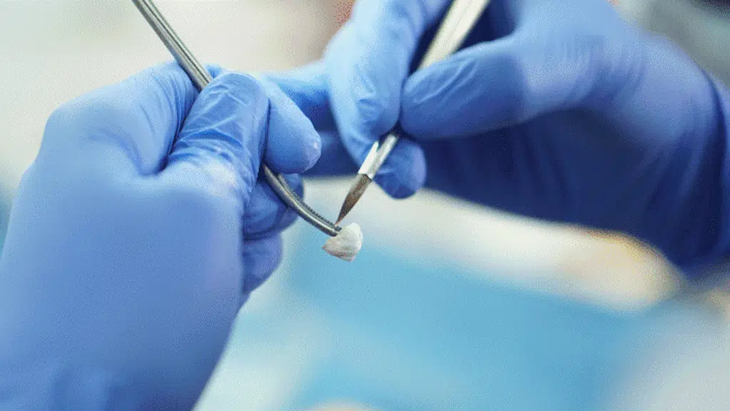 TeethFast Dental Lab - Best Dental Lab in India