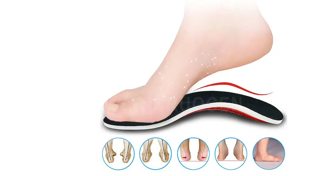 CloudWalk Orthotics