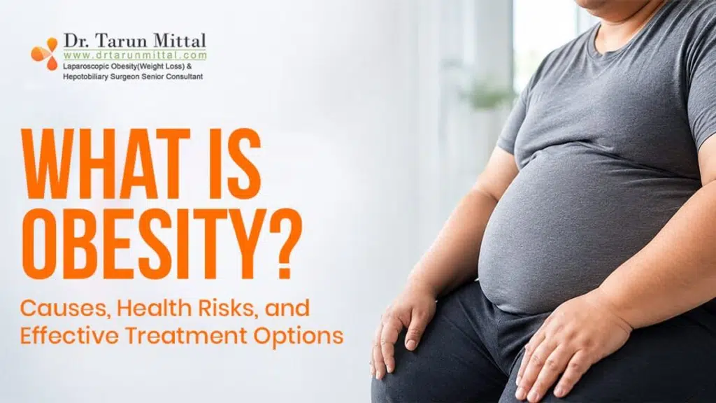 Dr. Tarun Mittal - Bariatric Surgeon In Delhi
