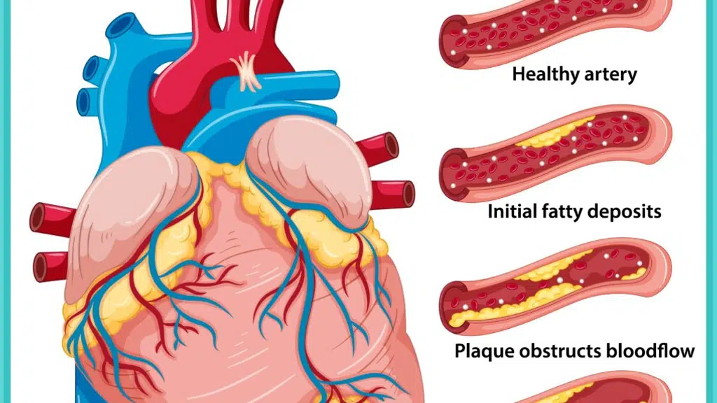 Srija Heart Care Hospital - Dr. Subhash Dukiya