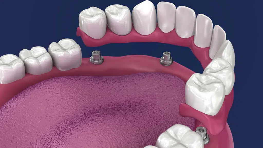 Venkateshwar Dental