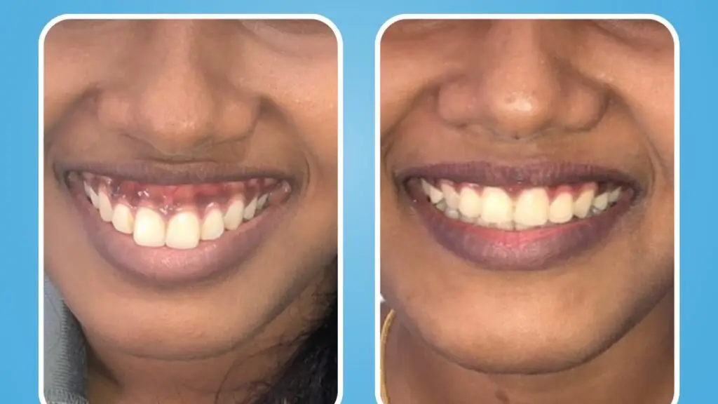 Vallamattam Advanced Orthodontics and Dental