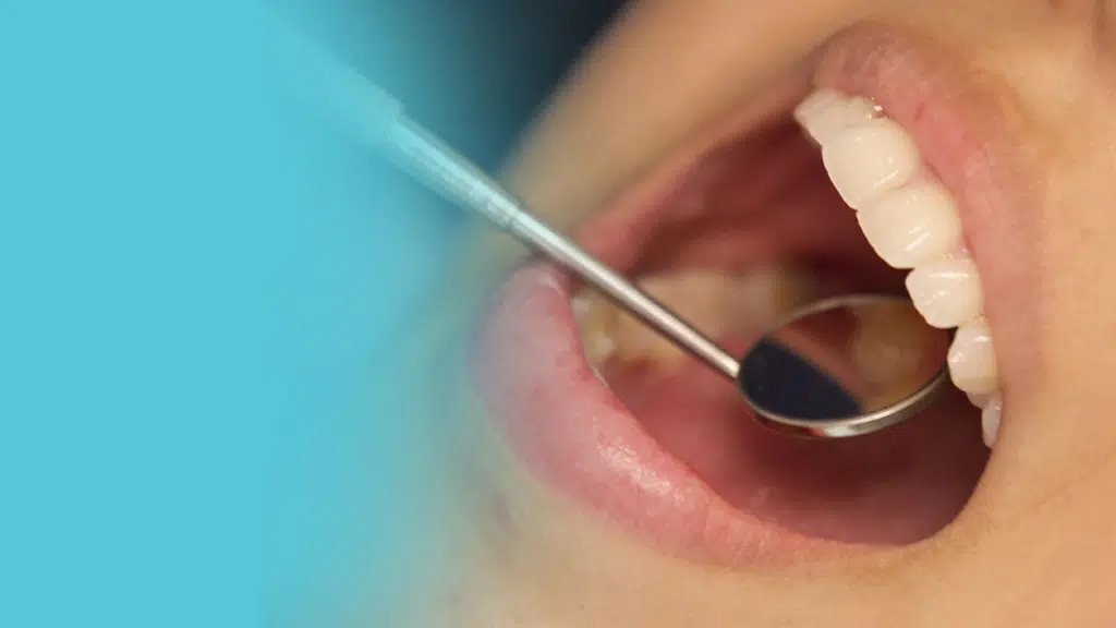 Shraddha Dental care