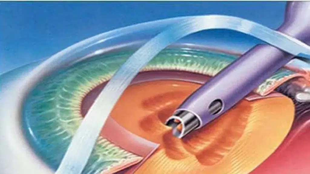 R K Eye and Retina Center