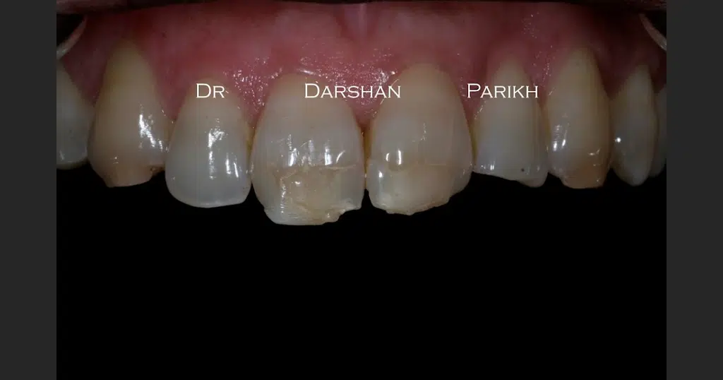 Vimal Dental Clinic in Pune Camp