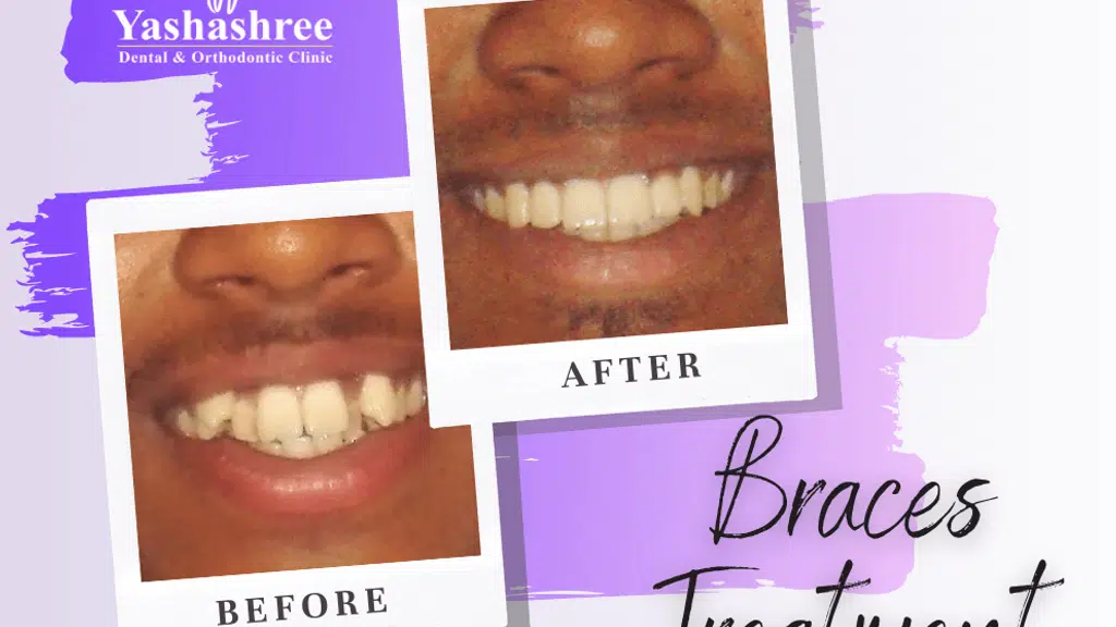 Yashashree Dental & Orthodontic Clinic