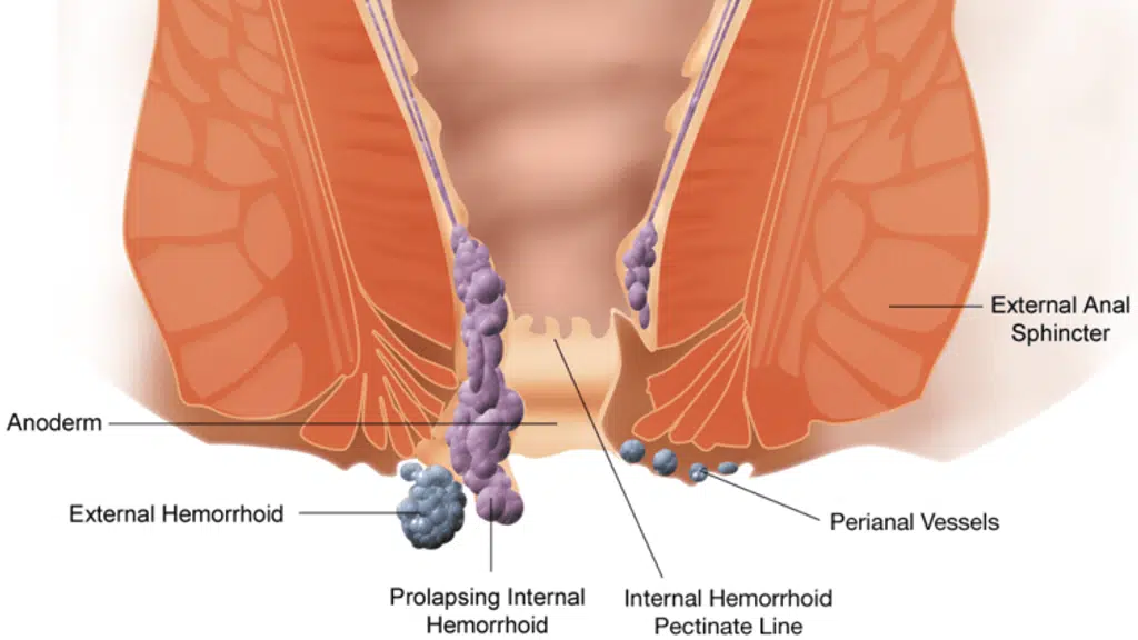 The Laser Gastroenterology Clinic