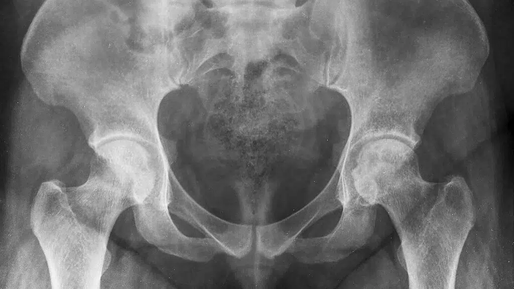 Dr.Ankur Sharma Spine and Joint Clinic