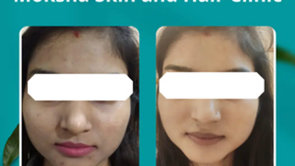 Moksha Skin & Hair Clinic