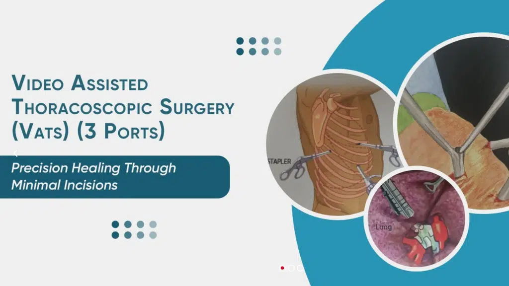 Dr. Kshitij Thoke – Orthopedic Surgeon in Kharghar | ACL Reconstruction, Shoulder Arthroscopy, Rotator Cuff Repair surgeon