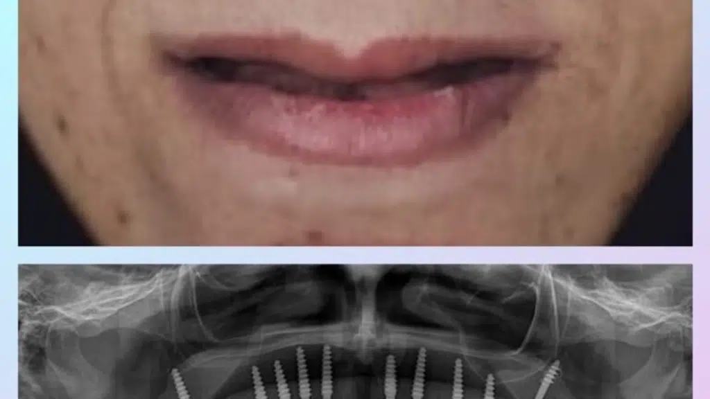 Spruce Dental