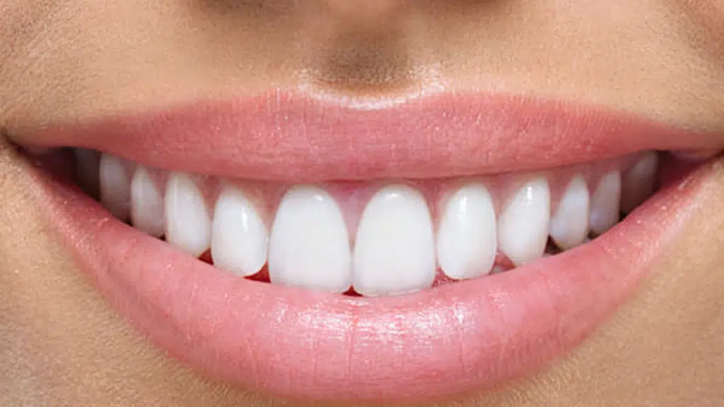 Sheth Dental Clinic Implants and Laser Centre