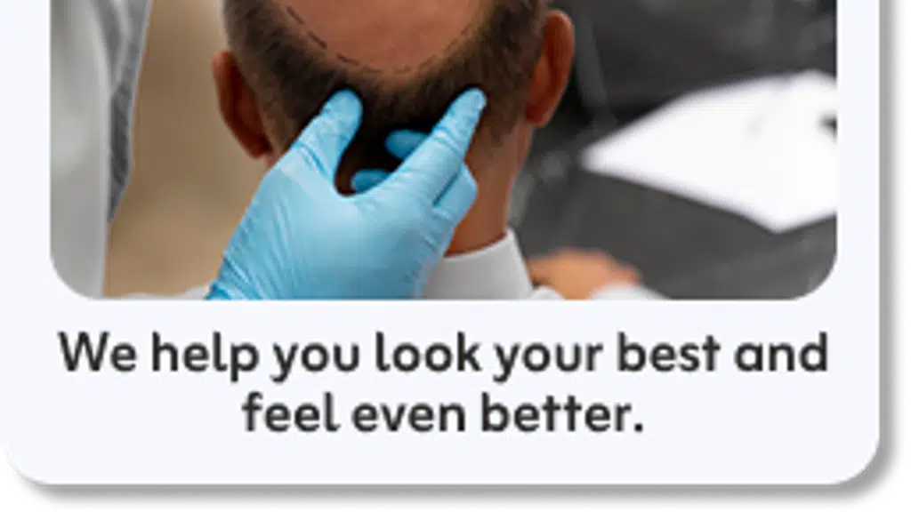 OSCAS Hair transplant clinic