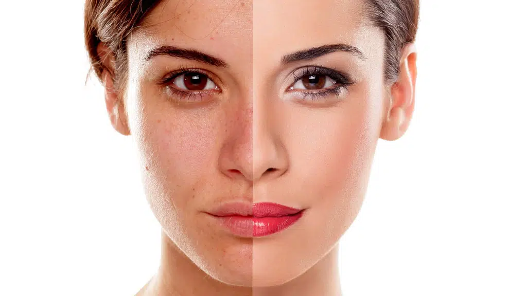 Lavanya Skin Clinic