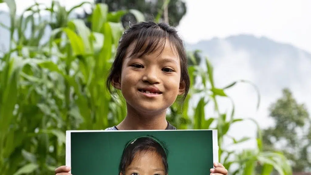 Smile Train India