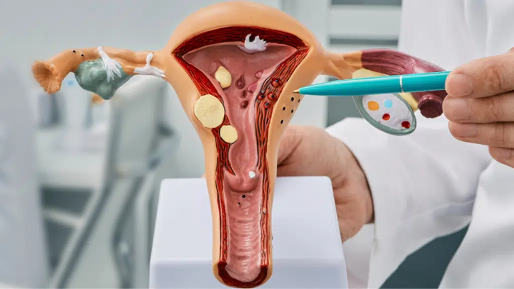 Dr. Divya Sehra - Top Gynae Oncologist & Onco Surgeon