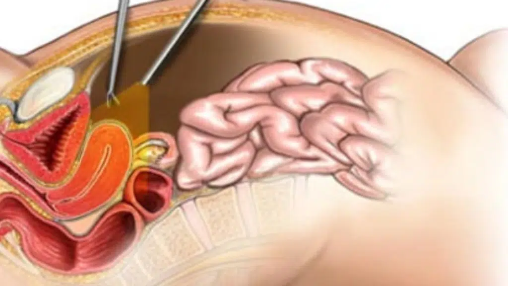 Dr Kunaal Shinde - Gynaec Laparoscopic Surgeon and Robotic Onco Surgeon