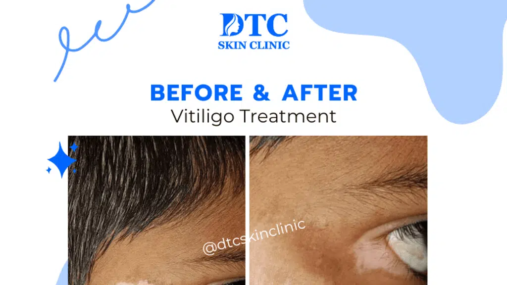 DTC Skin Clinic
