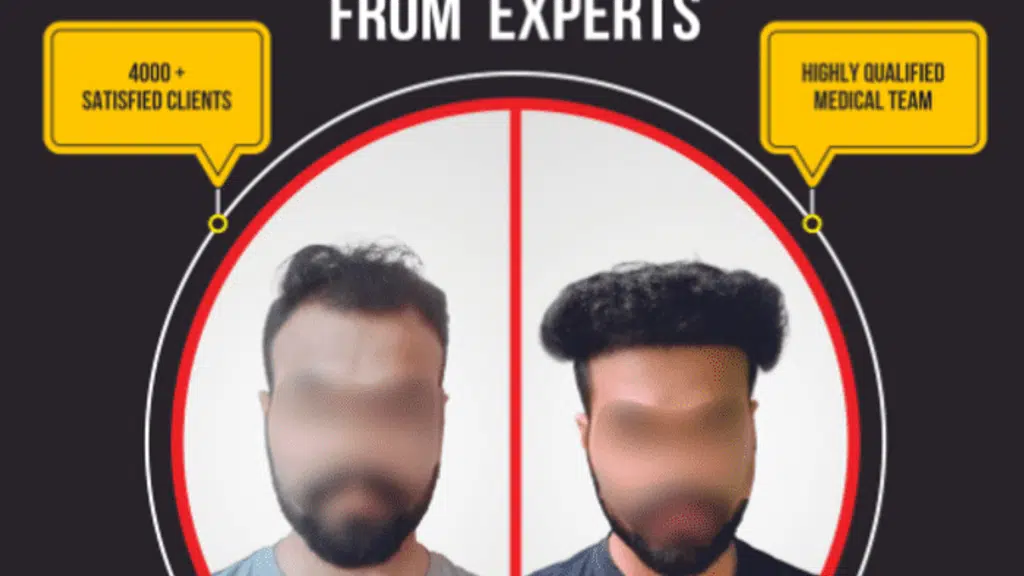 HSN Super Speciality Hair Transplantation Centre